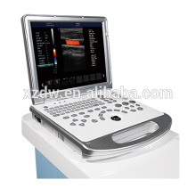 échographe portable Doppler couleur 4D et scanner échographe portable DWC60 PLUS